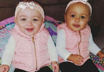 Бір-біріне көп ұқсамайтын, нәсілі бөлек егіздер дүниеге келді