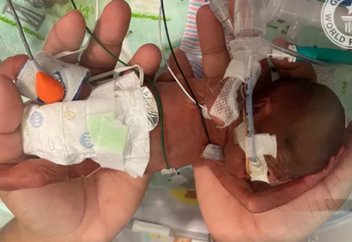 Мировой рекорд самых ранних родов установлен в США. Видео и фото