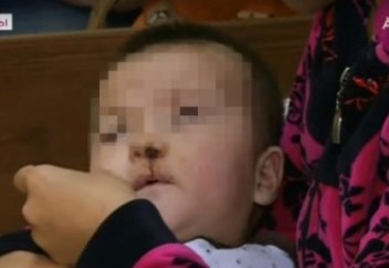 Бала не себепті қоянжырық дертімен туады?