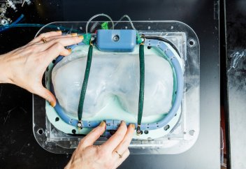 Тыныс алуға көмектесетін, имплантацияланатын «желдеткіш» жасалды