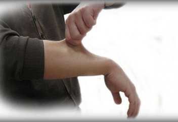 Проблемы с кожей, которые могут быть признаком серьезного заболевания