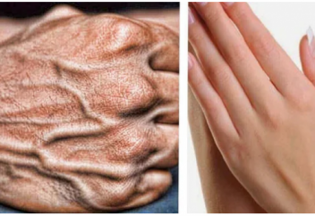 Почему у некоторых людей сильно видны вены?