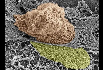 Иммунные клетки прорывают кровеносные сосуды на пути к защите организма (видео)