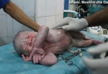 ДӘРІГЕРЛЕР ӨЛІ ТУҒАН БАЛАНЫ ТІРІЛТІП АЛДЫ (ВИДЕО)