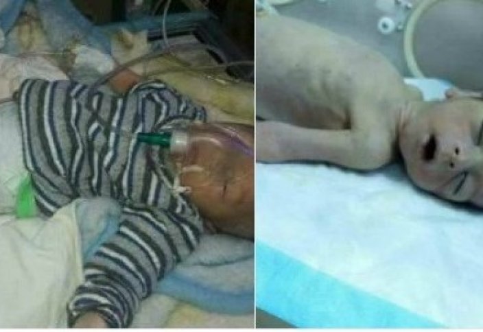 Сирийские младенцы погибли от холода