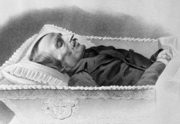 Самые известные случаи летаргического сна