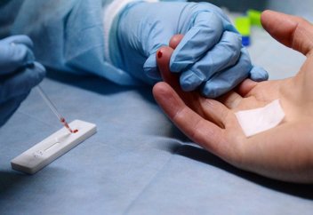 Правила расследования случаев заражения ВИЧ-инфекцией утвердили в РК