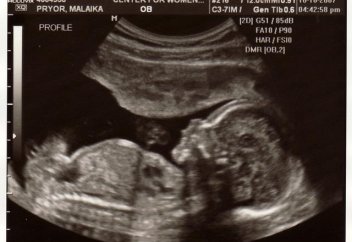 В Китае накажут медцентры, помогающие родителям узнать пол ребенка до его рождения