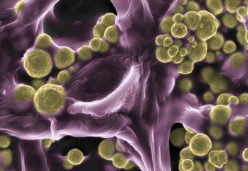 Алтын бөлетін өсімдік табылды