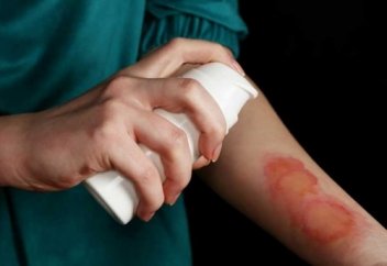 Күйіп қалғанда алғашқы көмек көрсету: не істеуге болады және болмайды