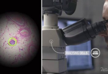 Google рак жасушаларын анықтайтын компьютер жасап шығарды (видео)