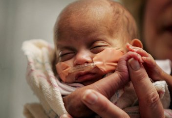 Ластанған ауадан жыл сайын 6 млн бала шала туады