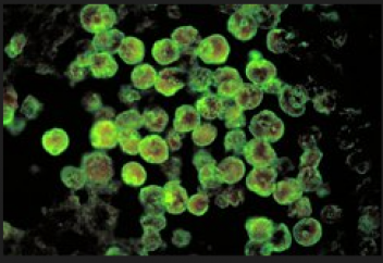 Ми кеміретін амеба климат өзгерісіне байланысты жылдам тарала бастады