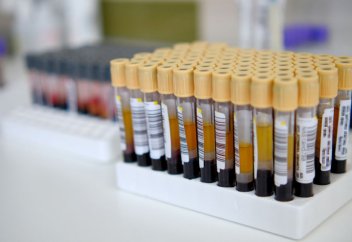 Нанопластик организмге өзімен бірге ауыр металдарды ала кіреді