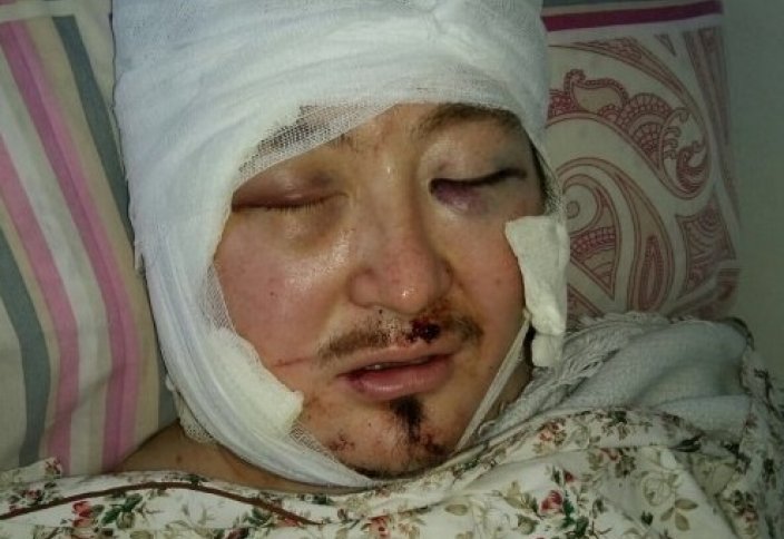 Члены ДАИШ, напавшие на теолога, задержаны в Турции