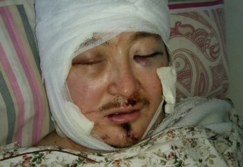 Члены ДАИШ, напавшие на теолога, задержаны в Турции