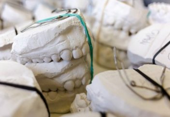 Ғалымдар тісті өздігінен емдейтін пломба ойлап тапты