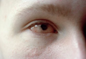 Бір ген бар, көздің көру қабілетін жақсартатын