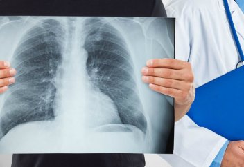 Туберкулезге қарсы төңкеріс жасайтын вакцина сынақтан өтті