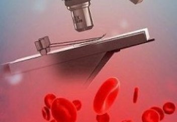 Қан анализіне қарап, адамның қаншалықты ғұмыры қалғанын анықтауға болады