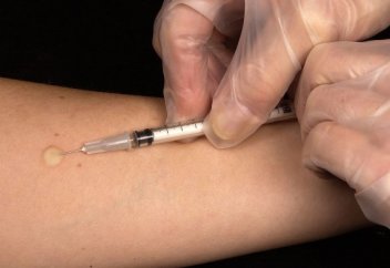 В Казахстане туберкулез будут выявлять с помощью пробы Манту и дополнительных тестов