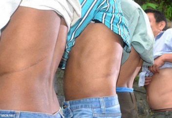 Үй алу үшін бүйректерін сатып жатыр