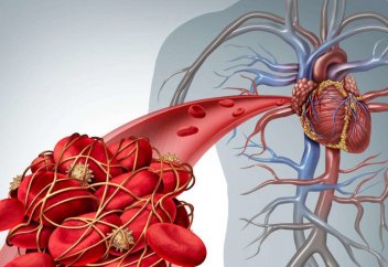 Қан сұйылтудың пайдасы (Дәрігер маманның қан сұйылту тәсілдері туралы кеңестері)