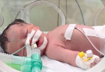 Ажал құшқан анасының құрсағынан жарып алынған шарана да шетінеп кетті