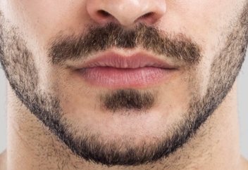 Сақал тері обырынан сақтайтын болып шықты