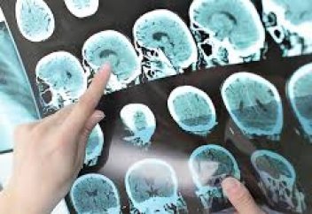 Болашақта пайда болатын емі жоқ аурудың белгісі аталды