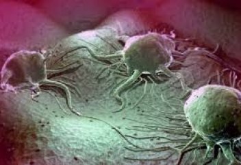 Ұрын келетін дерттің жай-жапсары