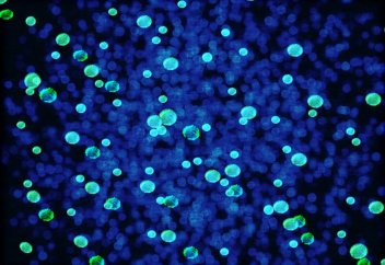 Ішек бактериясы қауіпті сипатқа ие болып келеді – өзге ағзаларды да зақымдауға көшті